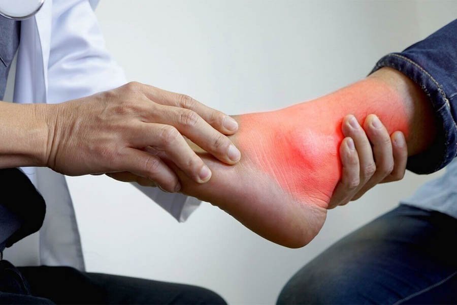 Bệnh Gout Hay Bệnh Gút Là Gì? Nguyên Nhân Và Cách Điều Trị Bệnh Gout