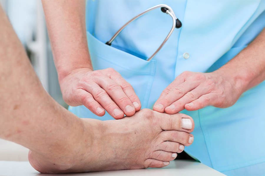 15 Cách Chữa Bệnh Gout Bằng Thuốc Nam Đơn Giản, Dễ Tìm