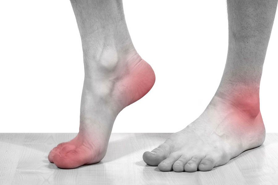 15 Cách Chữa Bệnh Gout Tại Nhà Siêu Hiệu Quả