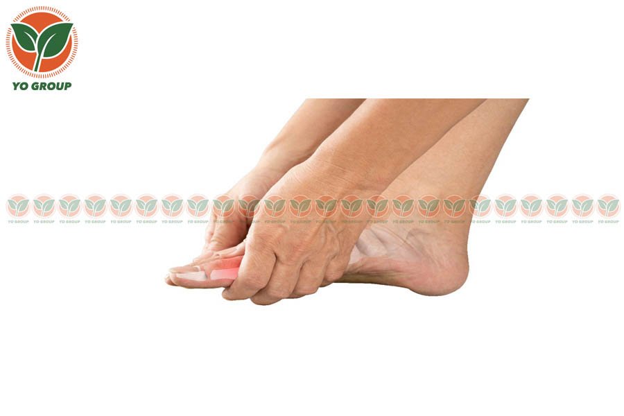 Bật Mí 9 Cách Phòng Ngừa Bệnh Gout Được Chuyên Gia Khuyên Dùng 2 Bật Mí 9 Cách Phòng Ngừa Bệnh Gout Được Chuyên Gia Khuyên Dùng