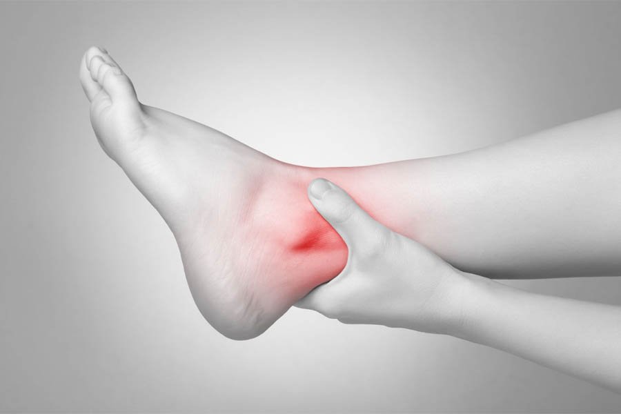Dấu Hiệu Bệnh Gout Ở Chân Cần Lưu Ý Để Chữa Trị Kịp Thời 6 Dấu Hiệu Bệnh Gout Ở Chân Cần Lưu Ý Để Chữa Trị Kịp Thời