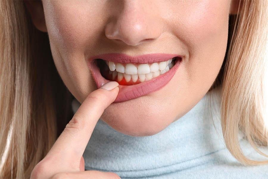 Trả Lời Thắc Mắc Có Nên Uống Collagen Liên Tục Không