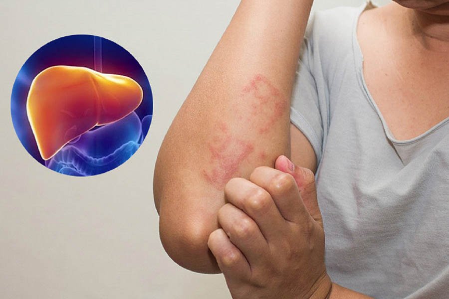 Có Nên Uống Trà Giải Độc Gan Hay Không? 5 Có Nên Uống Trà Giải Độc Gan Hay Không?